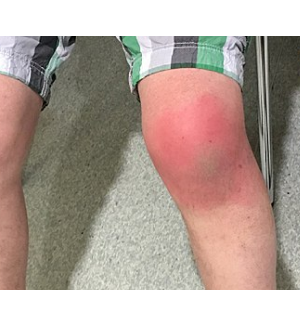 Knie